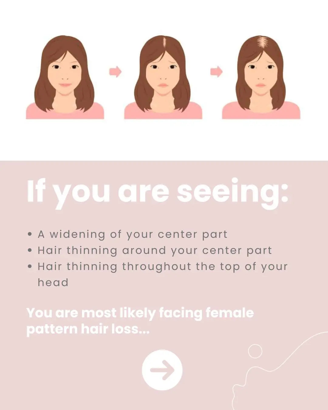 Zephta H-Regrow 2.0 Store Hub Arabia