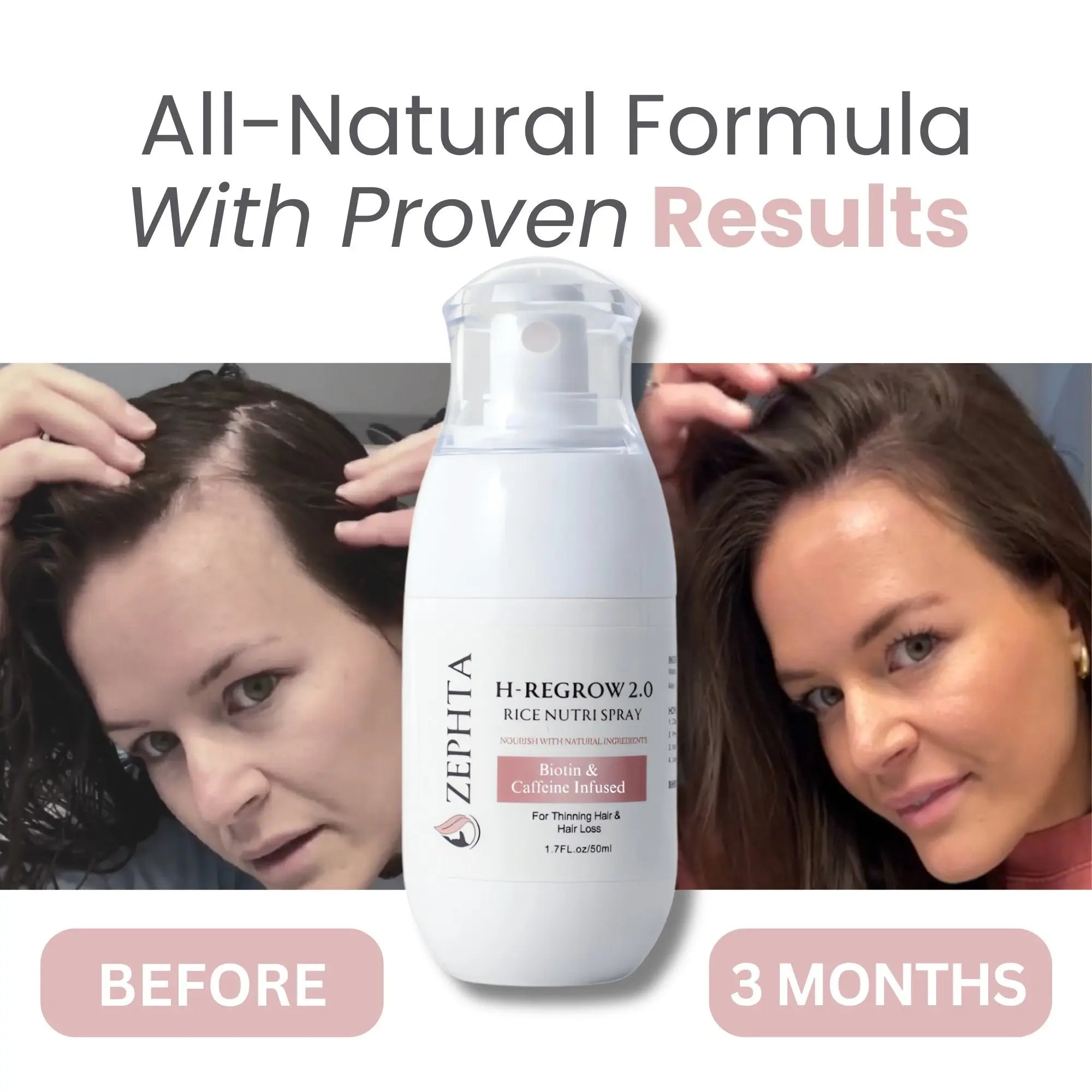 Zephta H-Regrow 2.0 Store Hub Arabia